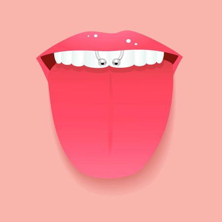 Smiley Piercing